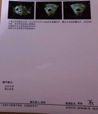 胎儿没胎心是什么原因,是什么原因导致的呢,胎儿无心跳是什么原因导致的 第3张 胎儿没胎心是什么原因,是什么原因导致的呢,胎儿无心跳是什么原因导致的 第3张