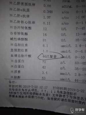 孕期胆酸检查(孕期胆酸检查是查什么) 第2张 孕期胆酸检查(孕期胆酸检查是查什么) 第2张