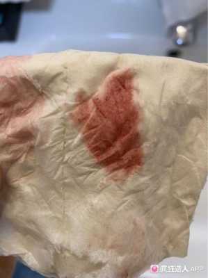 备孕期间出血(试管移植后10天开始一直流血是不是备孕失败啊) 第1张 备孕期间出血(试管移植后10天开始一直流血是不是备孕失败啊) 第1张