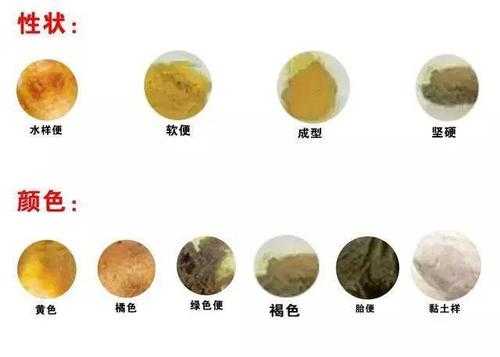 胎儿拉胎粪(胎儿拉胎粪是什么原因) 第1张 胎儿拉胎粪(胎儿拉胎粪是什么原因) 第1张