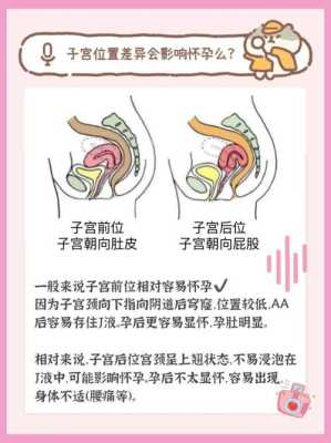 孕期子宫后位(子宫前位和子宫后位的区别到底是什么) 第1张 孕期子宫后位(子宫前位和子宫后位的区别到底是什么) 第1张