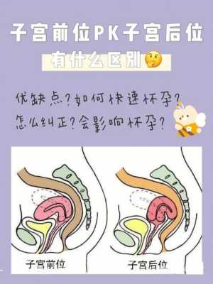 孕期子宫后位(子宫前位和子宫后位的区别到底是什么) 第3张 孕期子宫后位(子宫前位和子宫后位的区别到底是什么) 第3张