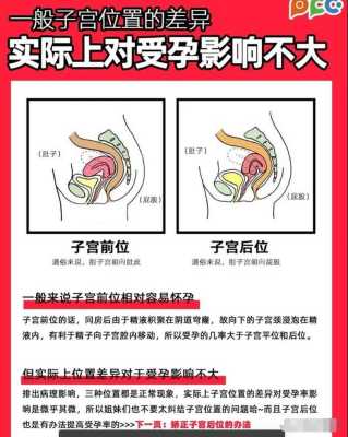 孕期子宫后位(子宫前位和子宫后位的区别到底是什么) 第2张 孕期子宫后位(子宫前位和子宫后位的区别到底是什么) 第2张