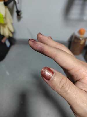 孕期染发剂(孕期染发剂沾到手上会怎么样) 第3张 孕期染发剂(孕期染发剂沾到手上会怎么样) 第3张