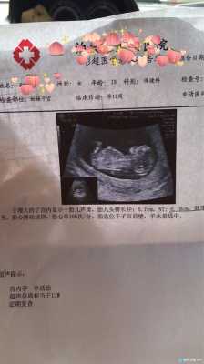 孕12周胎儿图(孕12周,孕吐越来越严重,怎么办) 第2张 孕12周胎儿图(孕12周,孕吐越来越严重,怎么办) 第2张