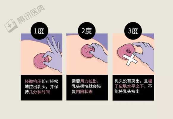孕期乳房有硬块（乳房有肿块，鸡蛋大小，硬硬的，该怎么办呢，希望得到尽快解决）  第3张