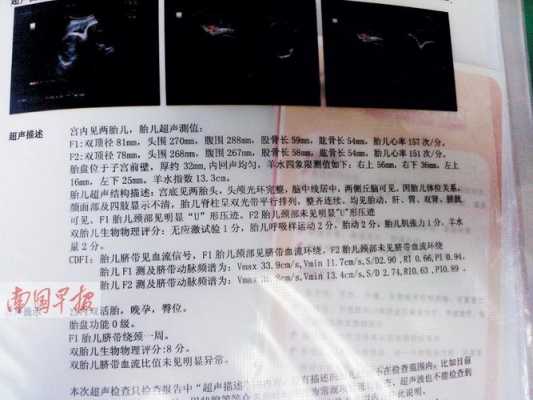 b超单上显示胎儿双肾未见明显分离是什么意思,胎儿双肾盂未见明显分离是什么意思 第2张 b超单上显示胎儿双肾未见明显分离是什么意思,胎儿双肾盂未见明显分离是什么意思 第2张