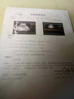 胎儿几个月查畸形(怀孕四个月做唐氏筛查,可以查出胎儿的智商与畸形是不是正常吗) 第2张 胎儿几个月查畸形(怀孕四个月做唐氏筛查,可以查出胎儿的智商与畸形是不是正常吗) 第2张
