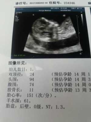 孕期nt几周做最好（孕期nt几周做最好,要空腹吗）  第1张