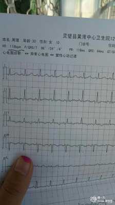 孕期心脏跳的快(胎儿心率快怎么回事) 第2张 孕期心脏跳的快(胎儿心率快怎么回事) 第2张