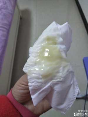 孕期流白带正常吗(怀孕有白带吗) 第3张 孕期流白带正常吗(怀孕有白带吗) 第3张