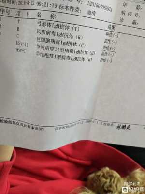 孕期病毒四项(孕期病毒四项检查结果) 第2张 孕期病毒四项(孕期病毒四项检查结果) 第2张