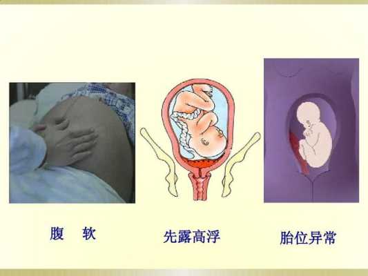 浮胎是什么意思,胎儿顶先露是啥意思 第1张 浮胎是什么意思,胎儿顶先露是啥意思 第1张