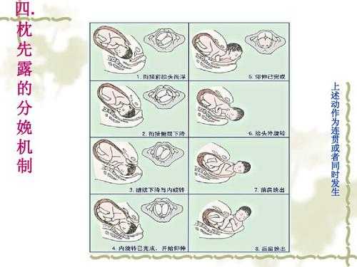 浮胎是什么意思,胎儿顶先露是啥意思 第2张 浮胎是什么意思,胎儿顶先露是啥意思 第2张