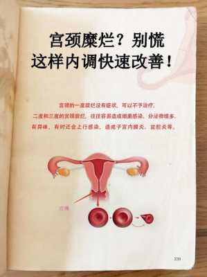 孕期宫颈糜烂怎么治疗（子宫颈糜烂怎么治疗）  第1张
