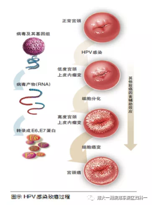 孕期怎么确定宫腔感染(宫腔内感染怎么治疗) 第1张 孕期怎么确定宫腔感染(宫腔内感染怎么治疗) 第1张