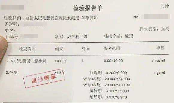 蚋虫绒毛怎么获取,胎儿绒毛提取流程 第2张 蚋虫绒毛怎么获取,胎儿绒毛提取流程 第2张