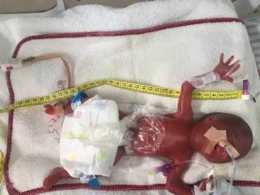 胎儿死图片(人为什么都要死呢?如果早晚都会死,那活着还有什么意义呢) 第1张 胎儿死图片(人为什么都要死呢?如果早晚都会死,那活着还有什么意义呢) 第1张