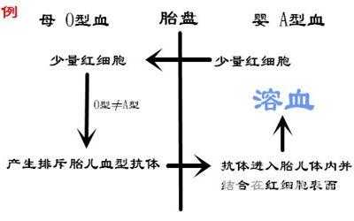 胎儿融血(abo溶血对胎儿发育有影响吗) 第2张 胎儿融血(abo溶血对胎儿发育有影响吗) 第2张