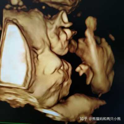 胎儿拱肚皮(胎儿拱肚皮是在干嘛) 第1张 胎儿拱肚皮(胎儿拱肚皮是在干嘛) 第1张