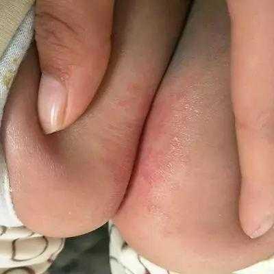 胎儿不排尿（胎儿不排尿怎么回事）  第2张