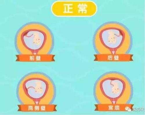 胎儿右侧壁(孕9月胎盘位于右侧壁正常吗?到医院检查发现胎盘位于右前壁) 第2张 胎儿右侧壁(孕9月胎盘位于右侧壁正常吗?到医院检查发现胎盘位于右前壁) 第2张