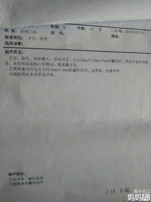 胎囊与胎儿(孕囊回声是什么意思) 第2张 胎囊与胎儿(孕囊回声是什么意思) 第2张