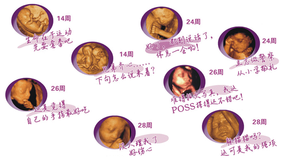 整个孕期要做几次四维彩超?一般只做1次就可以吗,怀孕期间做几次四维彩超合适 第1张 整个孕期要做几次四维彩超?一般只做1次就可以吗,怀孕期间做几次四维彩超合适 第1张