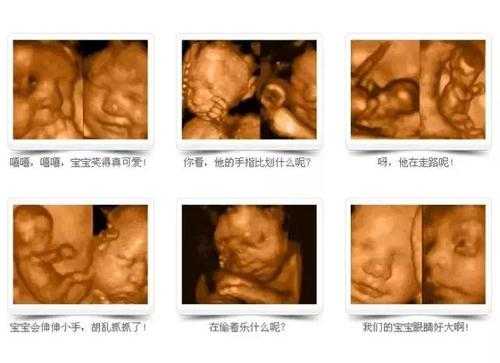 整个孕期要做几次四维彩超?一般只做1次就可以吗,怀孕期间做几次四维彩超合适 第2张 整个孕期要做几次四维彩超?一般只做1次就可以吗,怀孕期间做几次四维彩超合适 第2张