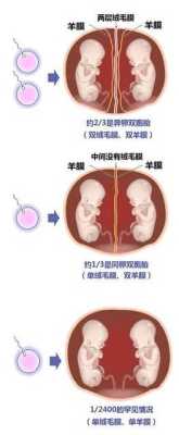 双胞胎的脐带是怎么连接的,胎儿的脐带连接图片 第1张 双胞胎的脐带是怎么连接的,胎儿的脐带连接图片 第1张