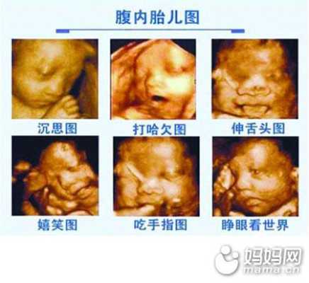 如何看胎儿彩超(如何看胎儿彩超图) 第1张 如何看胎儿彩超(如何看胎儿彩超图) 第1张