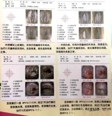 孕妇外阴红肿,发痒怎么办, 第1张 孕妇外阴红肿,发痒怎么办, 第1张