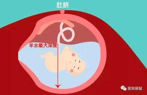 羊水偏多对胎儿有影响吗,羊水偏多对胎儿的影响及解决办法 第2张 羊水偏多对胎儿有影响吗,羊水偏多对胎儿的影响及解决办法 第2张
