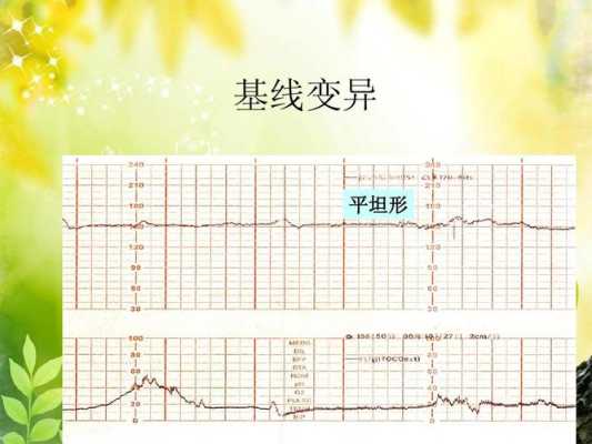 胎儿心动过缓是指(胎儿心动过缓是指胎心基线) 第1张 胎儿心动过缓是指(胎儿心动过缓是指胎心基线) 第1张
