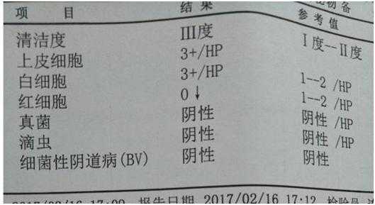 检查是否怀孕挂什么科?检查什么项目,孕期妇科检查清洁度三度是什么意思 第2张 检查是否怀孕挂什么科?检查什么项目,孕期妇科检查清洁度三度是什么意思 第2张