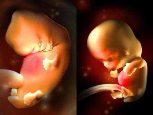 孕八周宝宝在肚子哪个位置,怀孕八周胎儿图片 第1张 孕八周宝宝在肚子哪个位置,怀孕八周胎儿图片 第1张