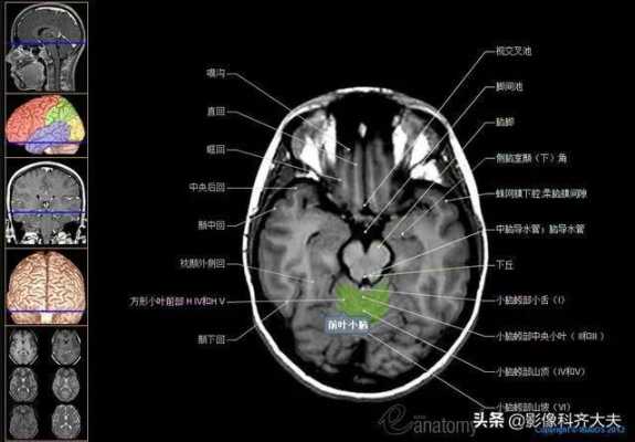 四个月宝宝做头颅核磁共振需要注意什么,胎儿磁共振多少钱一次 第2张 四个月宝宝做头颅核磁共振需要注意什么,胎儿磁共振多少钱一次 第2张