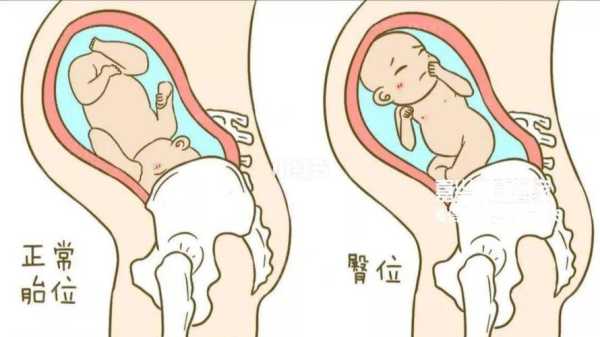 胎儿臀位胎动在哪里(胎儿臀位胎动在哪里动) 第1张 胎儿臀位胎动在哪里(胎儿臀位胎动在哪里动) 第1张