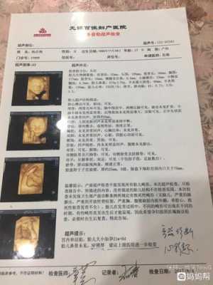 孕期排畸检查有哪些,胎儿排畸检查有哪些项目检查不出来 第2张 孕期排畸检查有哪些,胎儿排畸检查有哪些项目检查不出来 第2张