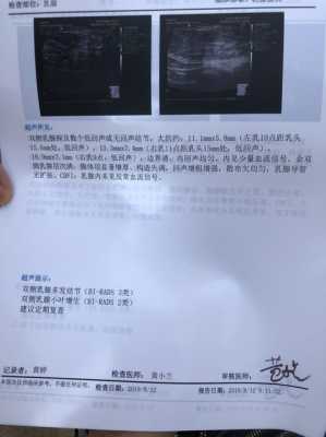 孕期乳房变大如何保持呢?吃什么好呢,孕期乳腺增大对乳腺彩超有影响吗 第2张 孕期乳房变大如何保持呢?吃什么好呢,孕期乳腺增大对乳腺彩超有影响吗 第2张