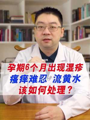 孕妇湿疹很严重怎么办呢,孕期湿疹治疗方案 第2张 孕妇湿疹很严重怎么办呢,孕期湿疹治疗方案 第2张