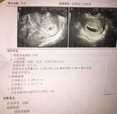彩超多长时间可以做一次,频繁彩超对胎儿的影响大吗 第1张 彩超多长时间可以做一次,频繁彩超对胎儿的影响大吗 第1张