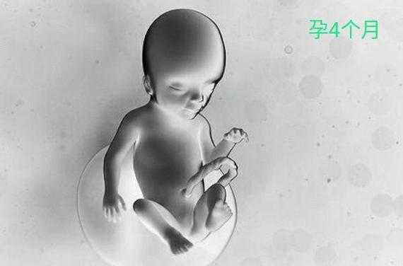聋哑胎儿能检查出来吗(聋哑胎儿能检查出来吗视频) 第1张 聋哑胎儿能检查出来吗(聋哑胎儿能检查出来吗视频) 第1张