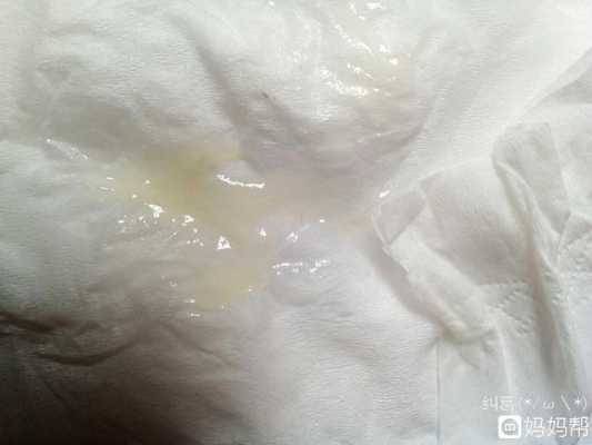 孕期私处湿(内衣里面每天湿湿的怎么办) 第3张 孕期私处湿(内衣里面每天湿湿的怎么办) 第3张