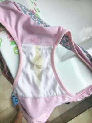 孕妇阴道炎对胎儿有影响吗(孕妇尿完尿一擦黄绿色分泌物) 第1张 孕妇阴道炎对胎儿有影响吗(孕妇尿完尿一擦黄绿色分泌物) 第1张