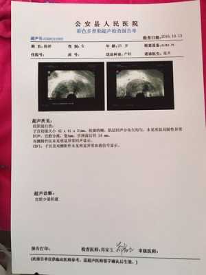 孕期出血宫腔有激液怎么办,孕期出血了 第2张 孕期出血宫腔有激液怎么办,孕期出血了 第2张