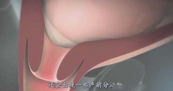 生孩子的真实过程,女人生孩子有多痛苦,胎儿分娩视频动画 第3张 生孩子的真实过程,女人生孩子有多痛苦,胎儿分娩视频动画 第3张
