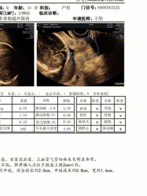 孕期查出宫颈管太短,是有什么原因造成的吗,美短孕期多长时间 第3张 孕期查出宫颈管太短,是有什么原因造成的吗,美短孕期多长时间 第3张