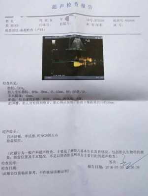 助产术名词解释,胎儿倒转术一般多少钱 第2张 助产术名词解释,胎儿倒转术一般多少钱 第2张