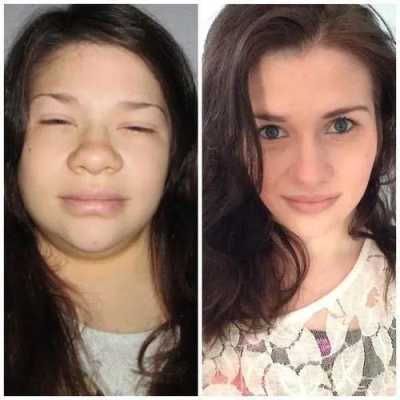孕妇脸肿是什么原因,孕期脸水肿的原因造成的 第2张 孕妇脸肿是什么原因,孕期脸水肿的原因造成的 第2张